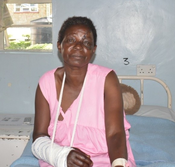 An injured woman sits on a hospital bed with her arm in a sling.